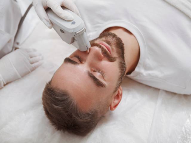 Depilación facial para hombres